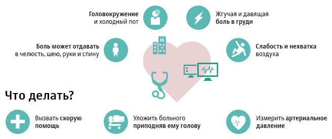 Признаки инфаркта миокарда